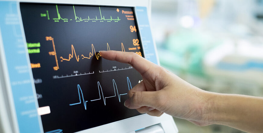 ECG-HITN