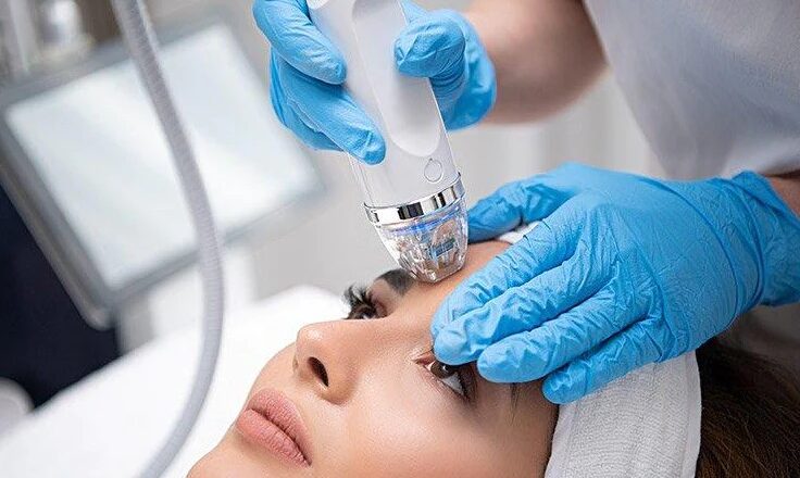 RF-Microneedling-vs-microneedling