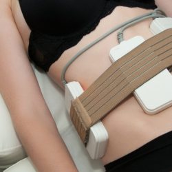 LASER LIPOLYSIS